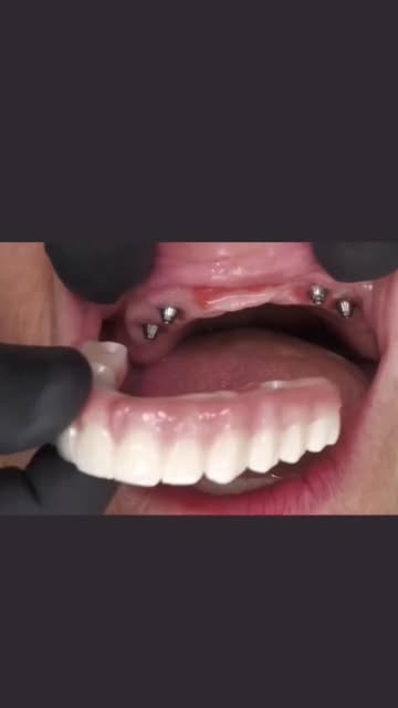 Smilers Dental Clinique
